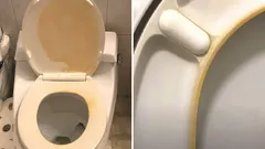 How to Remove Yellow Stains from Your Toilet Seat in 10 Minutes: An Easy DIY Cleaner